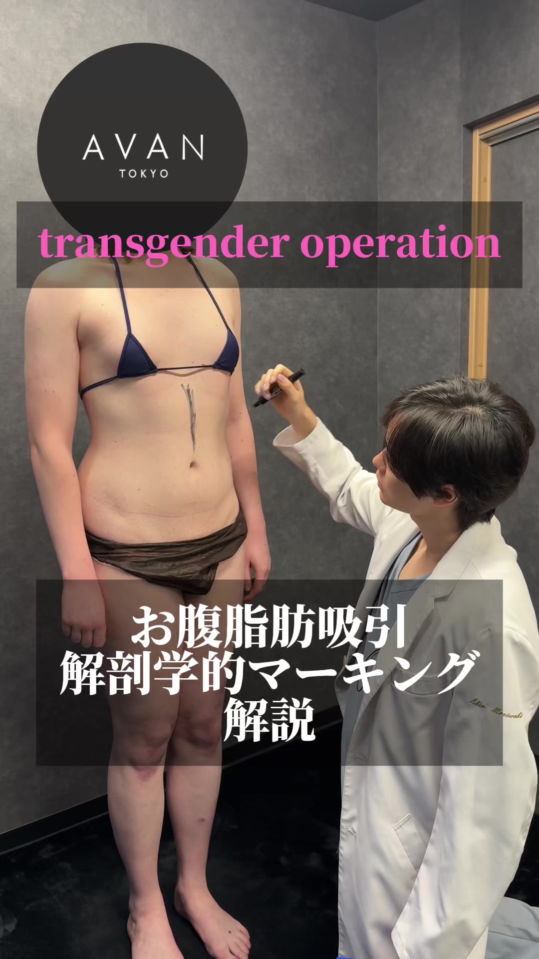 @SHIN/森脇 進の二の腕脂肪吸引・豊胸