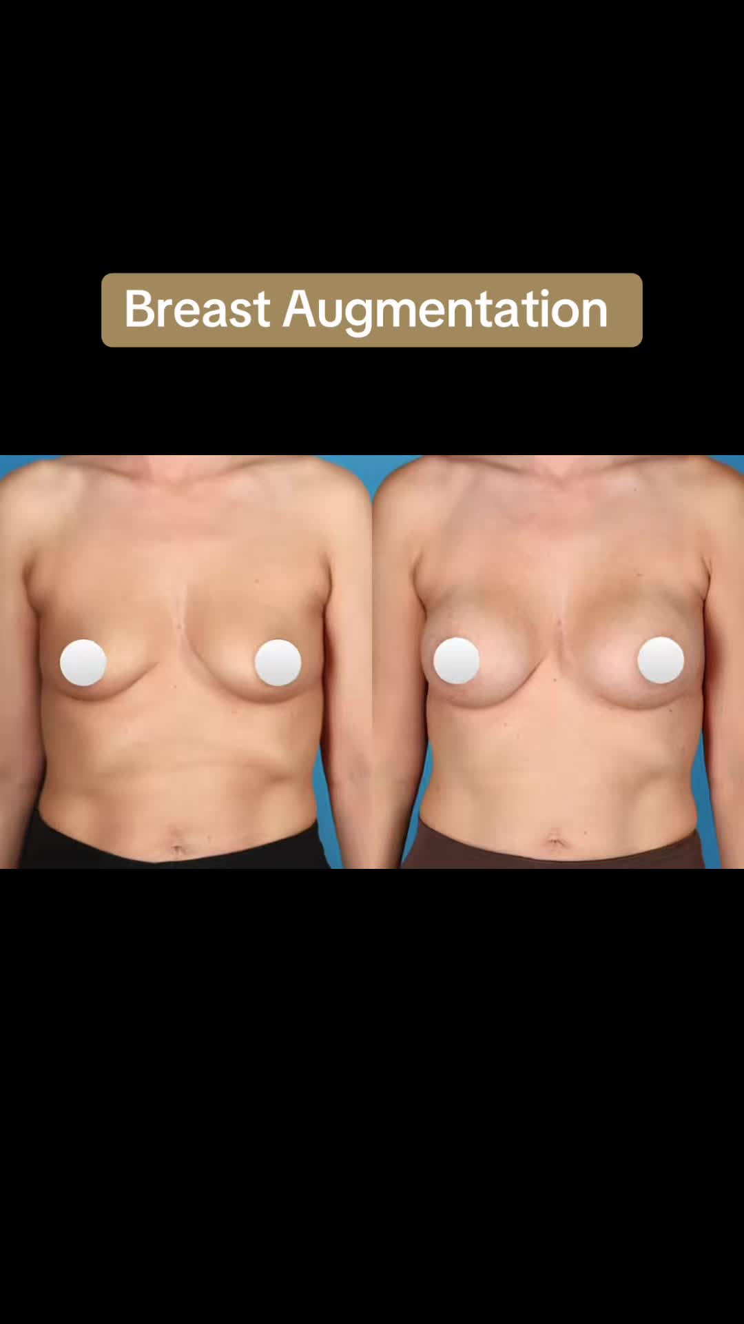 @Kelly Killeen, MD, FACS