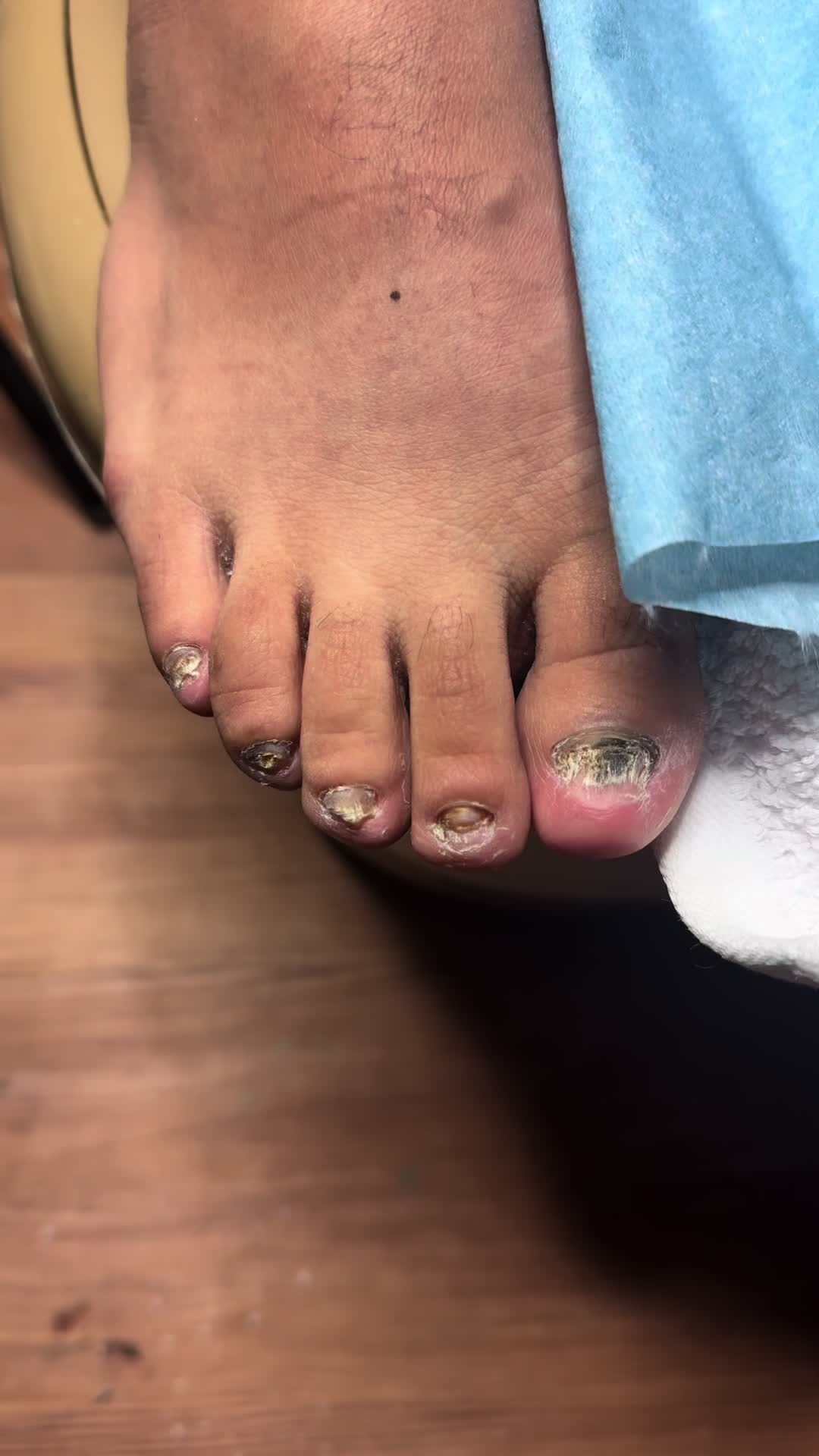 @ToesbyKoki