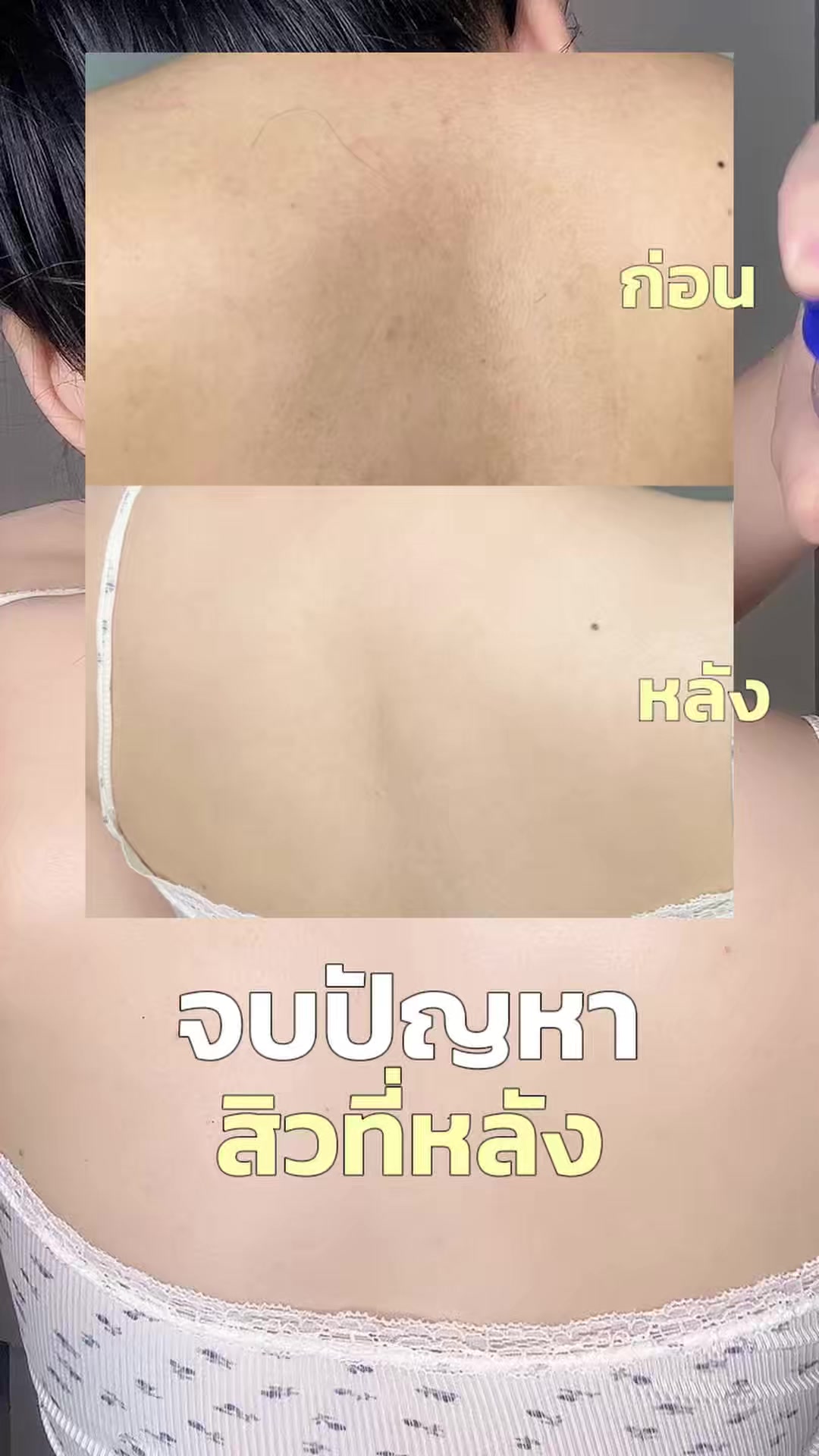 @Pimmyymyypim
