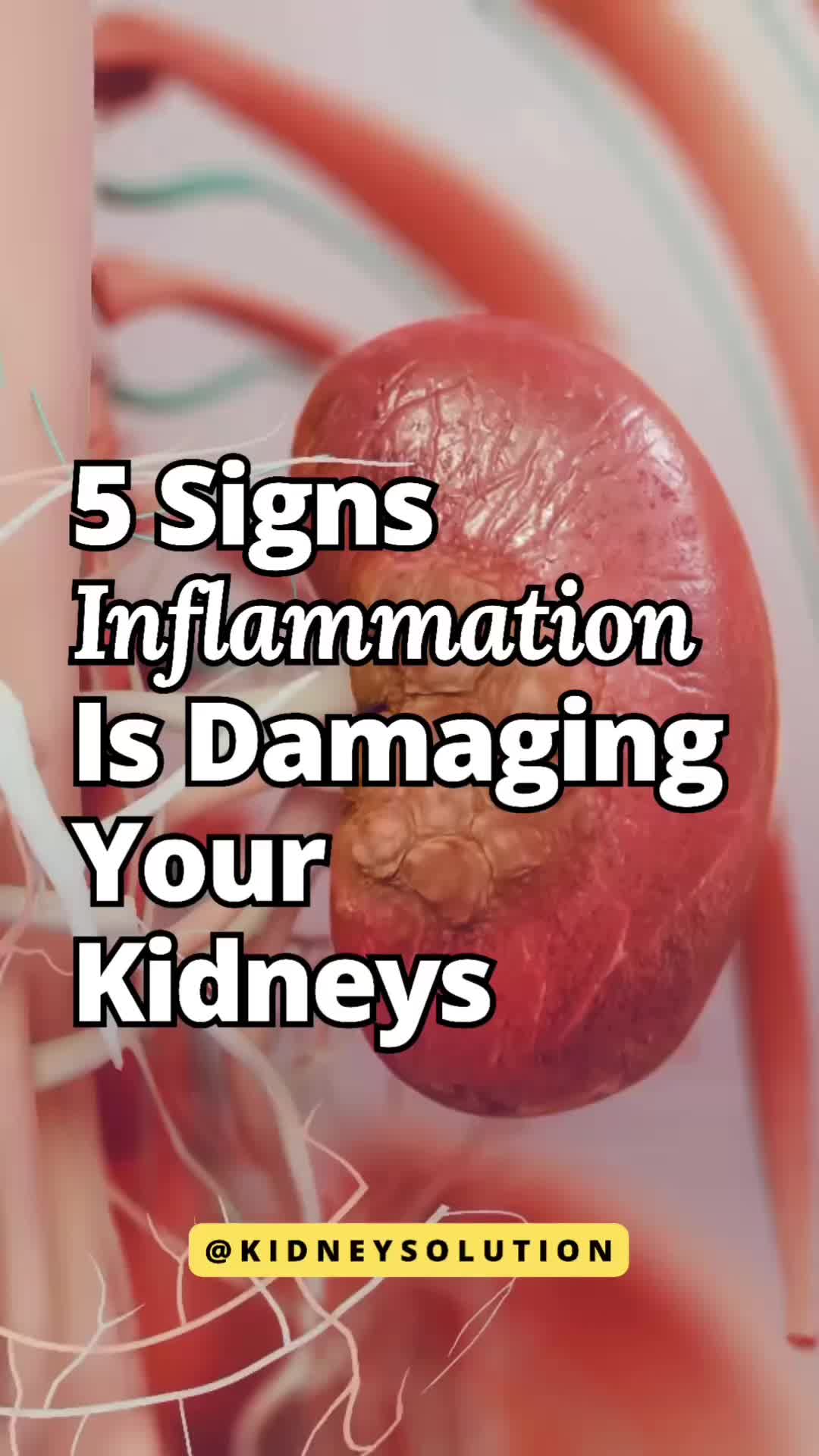 @Kidneysolution