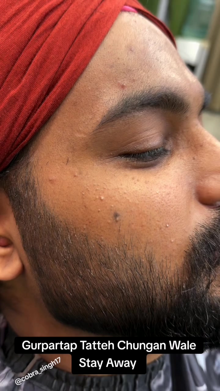 @cobra_singh17