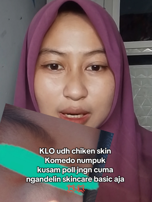 @imm🌷𐙚