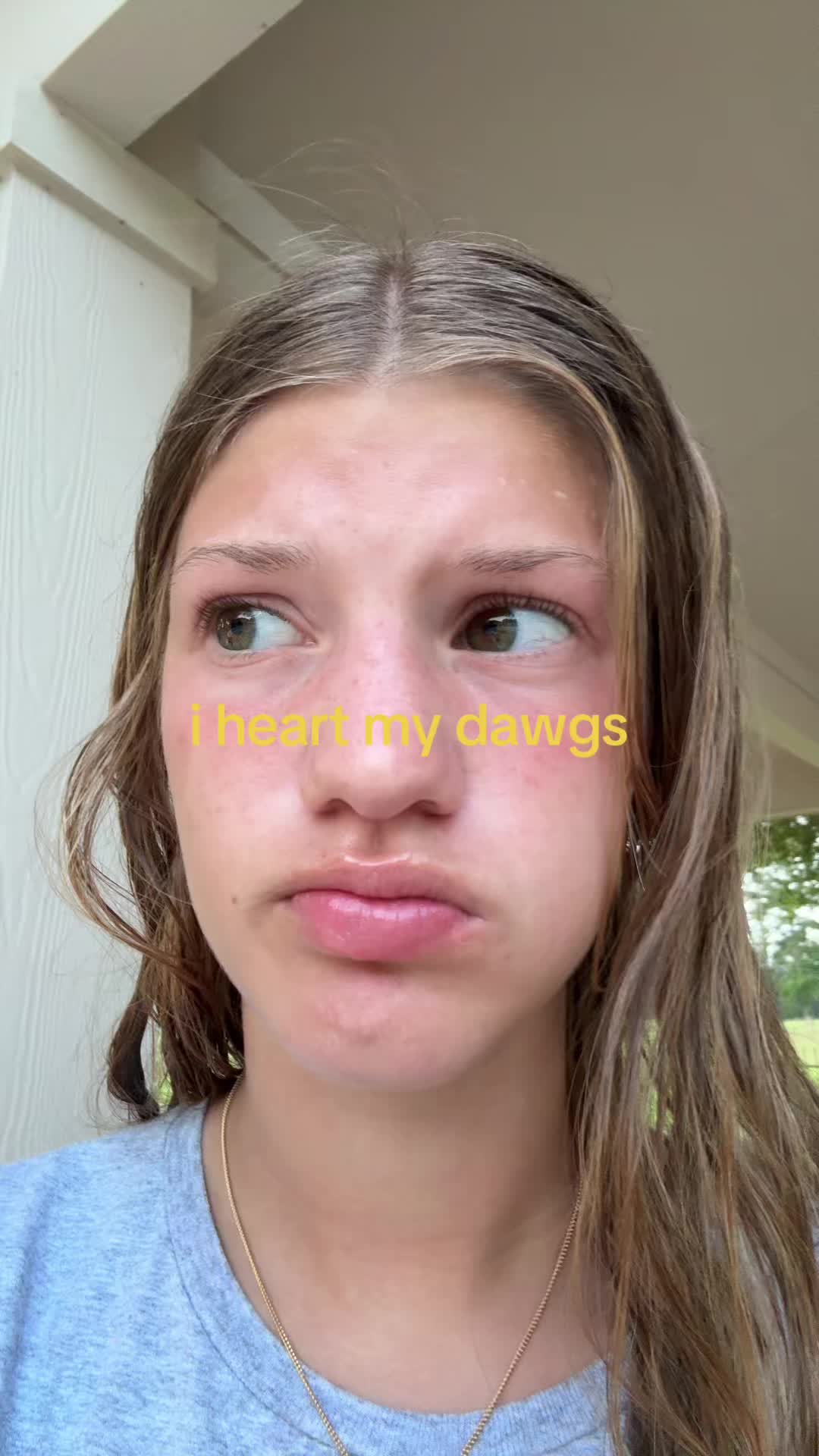 @🙈