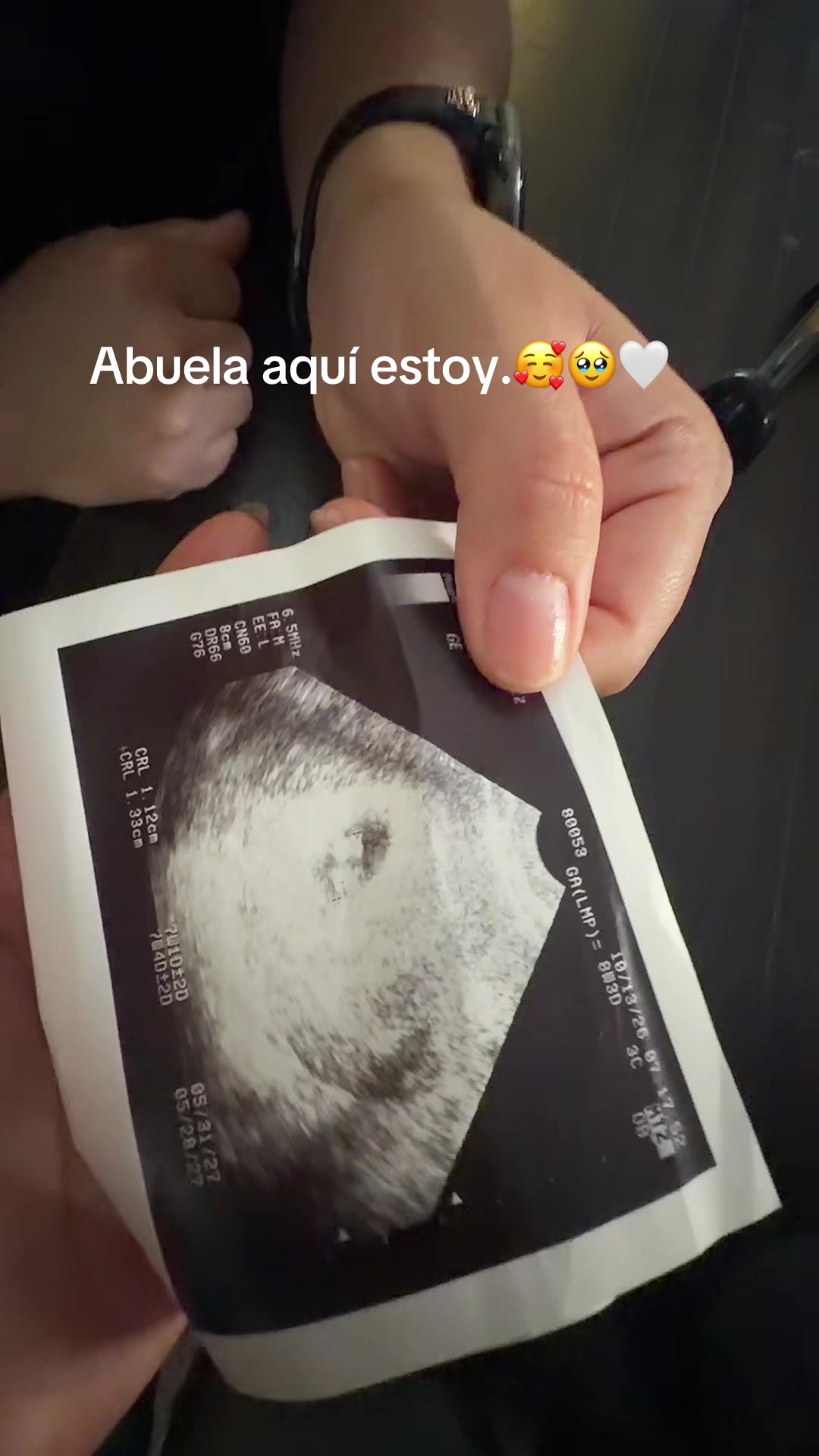 @Patty Tapatía