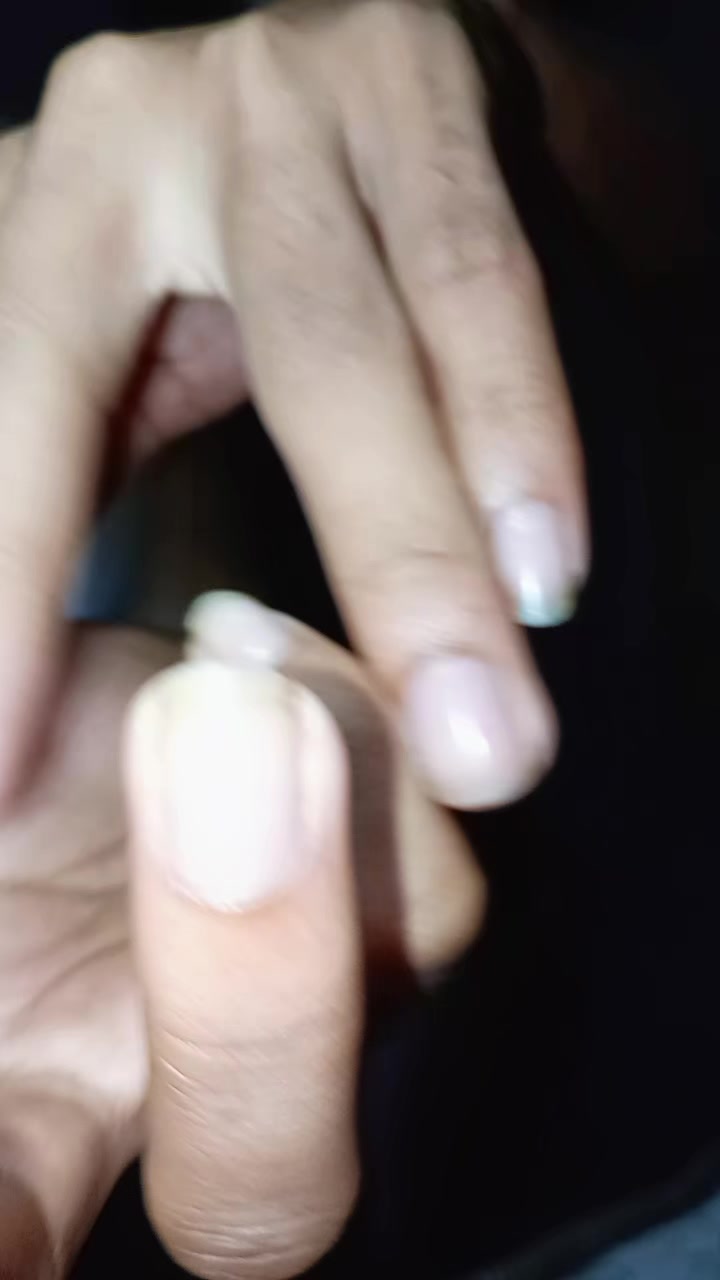 @Mi🐈&zwj;⬛