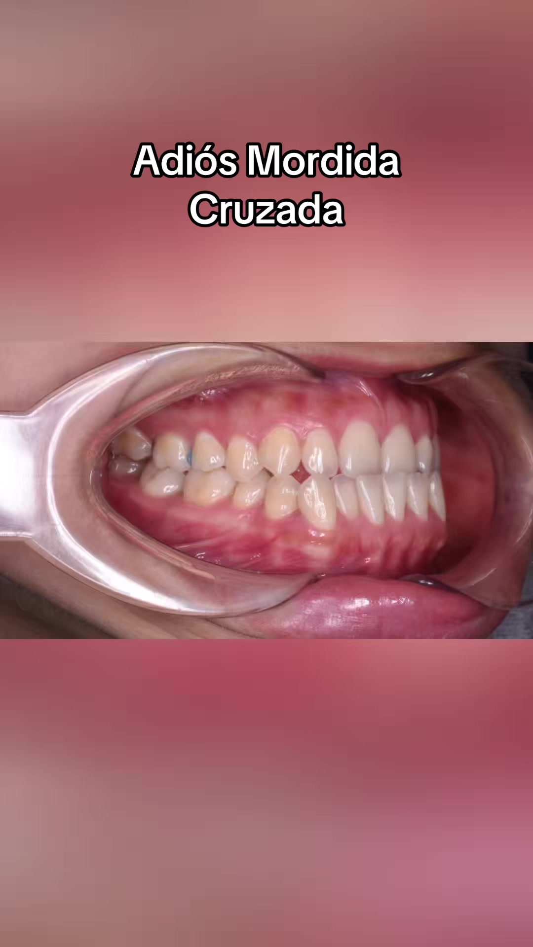 @DentikaBrackets