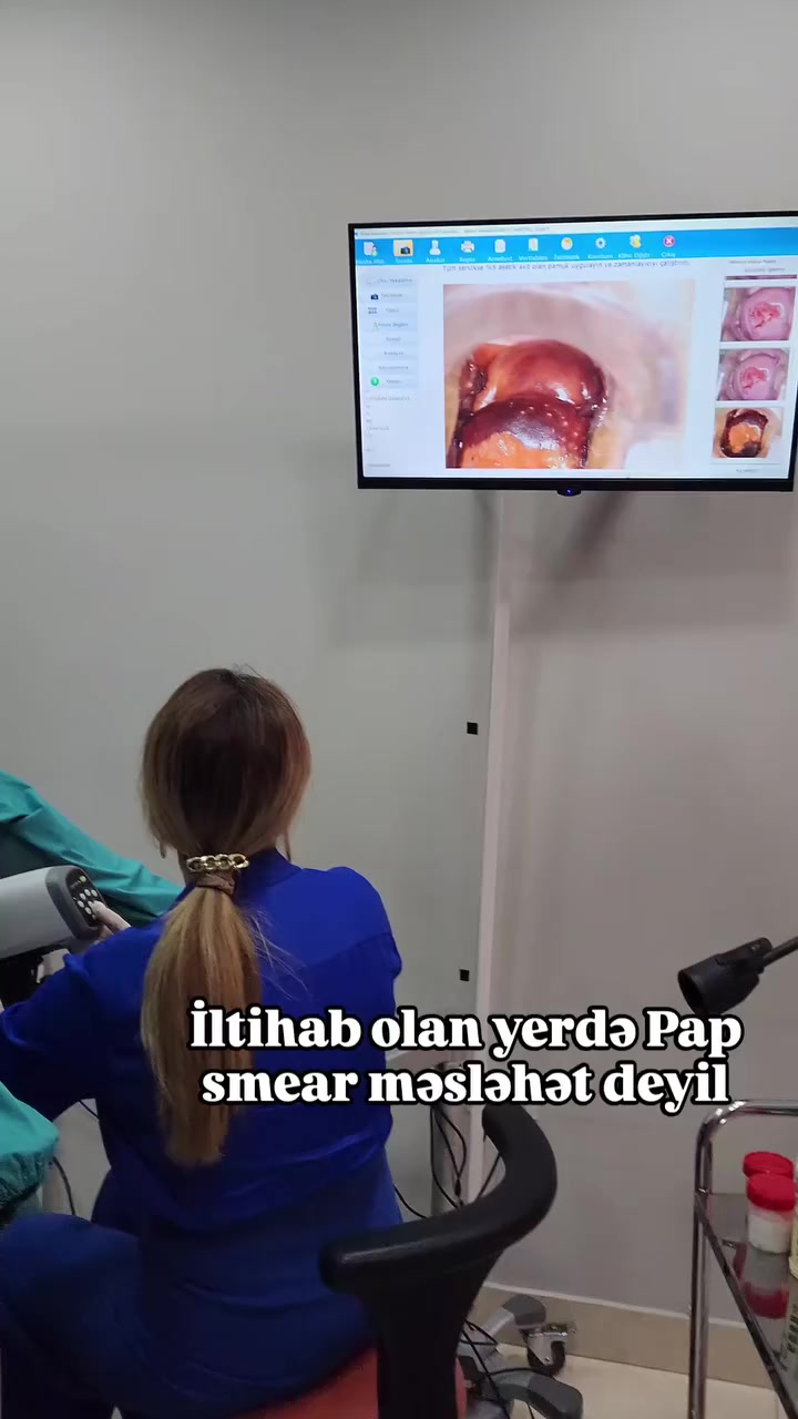 @Ginekoloq Esmira Hasanova