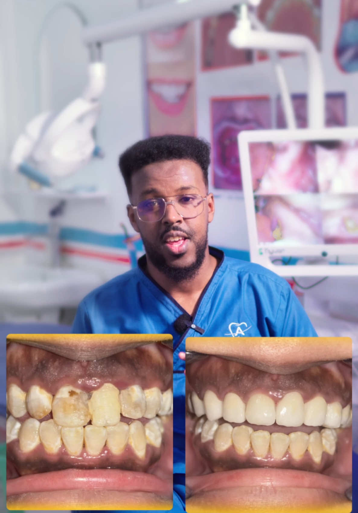 @Dr. Maano 🦷