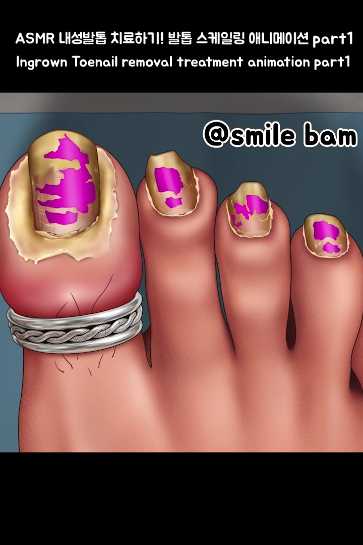 @Smile Bam