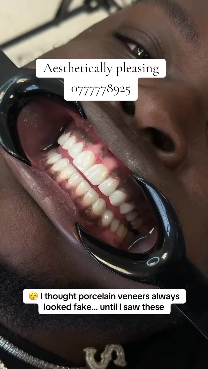 @๐ฟ๐ง ๐๐ข๐๐ก๐๐จ | ๐ฉ๐น๐ผ๐ด๐จ