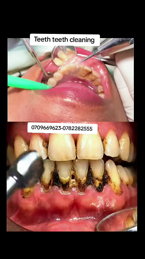 @@KAI Dentalcare123kampala