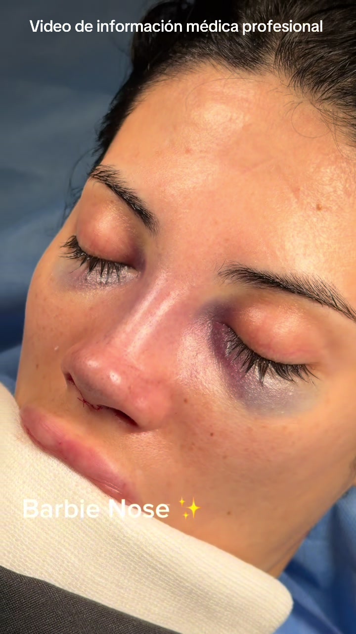 @drgarone.rinoplastia