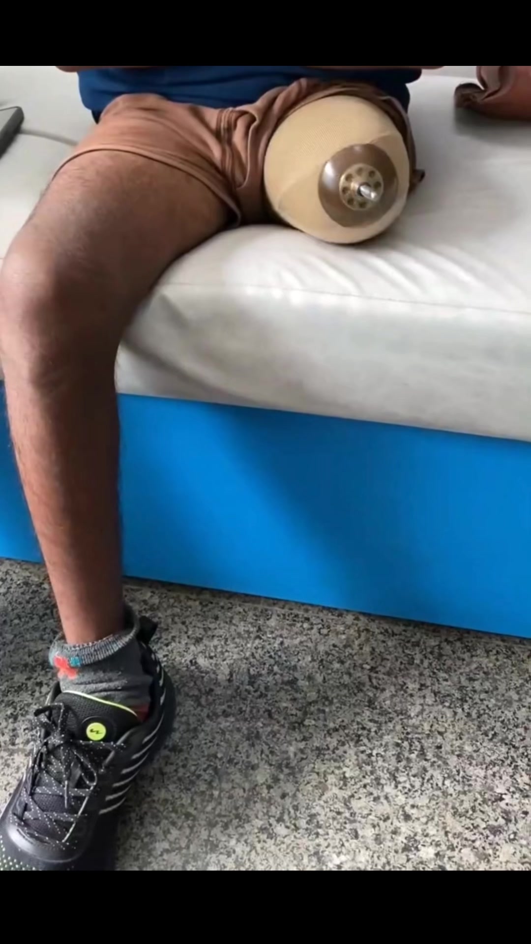 @مصنوعی اعضاء