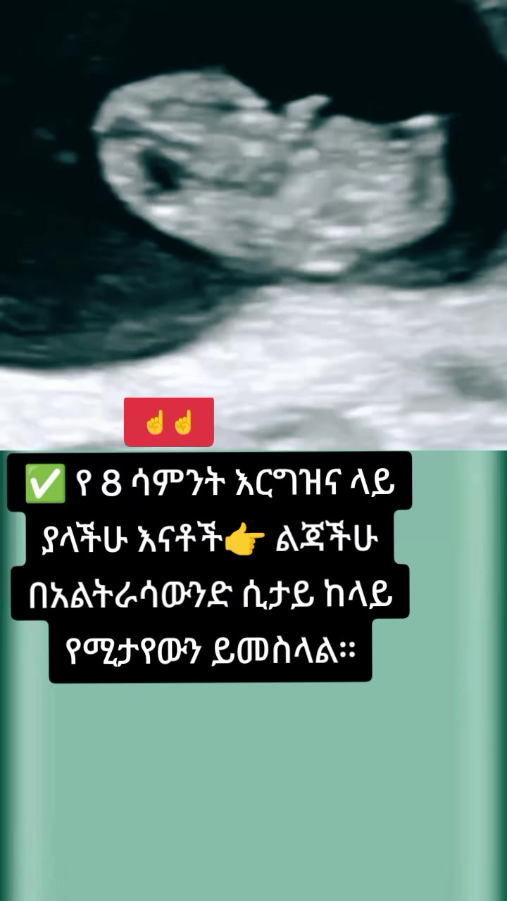 @🩺ዶ/ር ትዕዛዙ (የማህፀን እና ፅንስ ሃኪም)