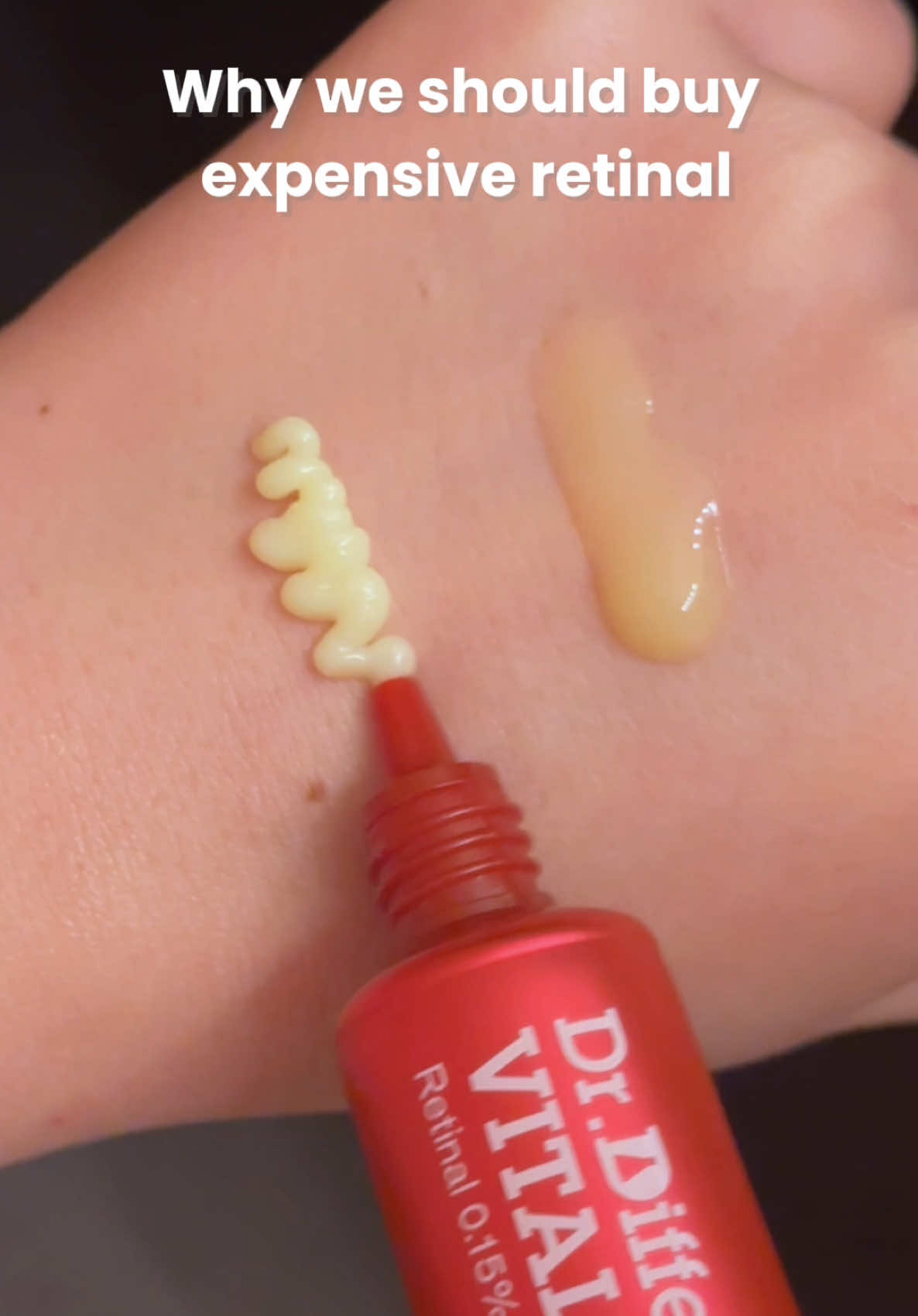 @storyofcheeze