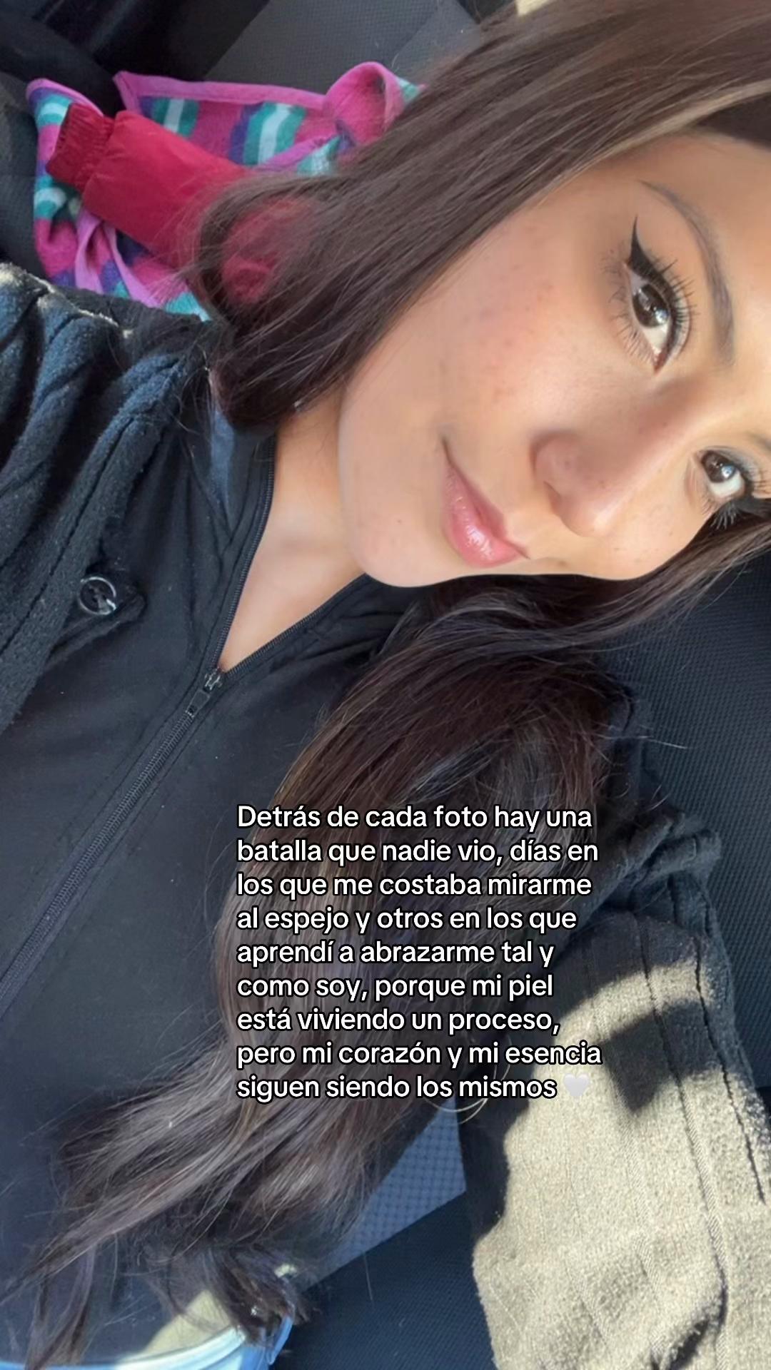 @Anyii
