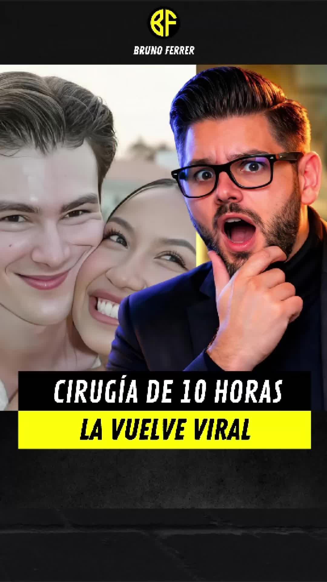 @Bruno Ferrer