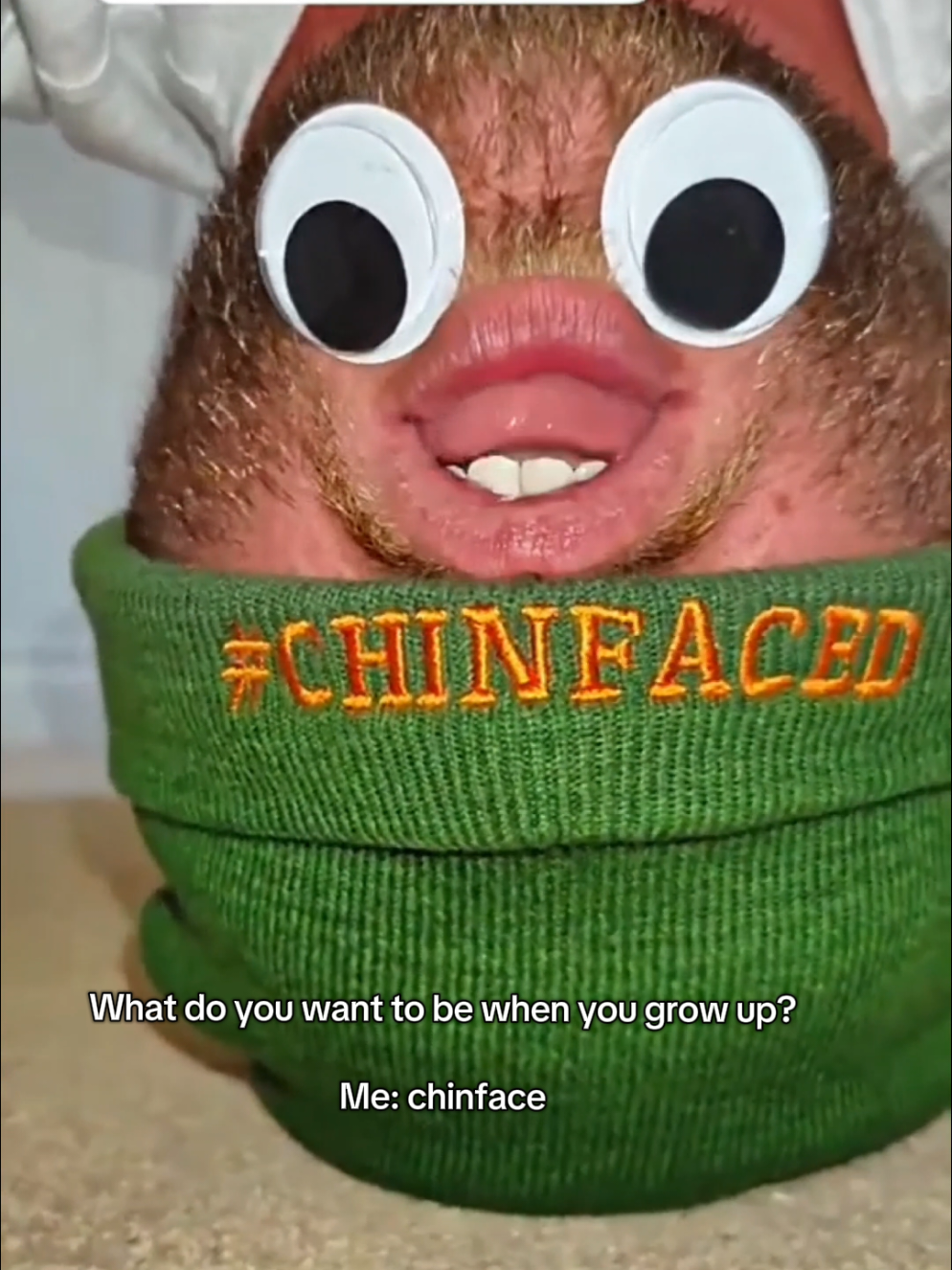 @Chinfaced