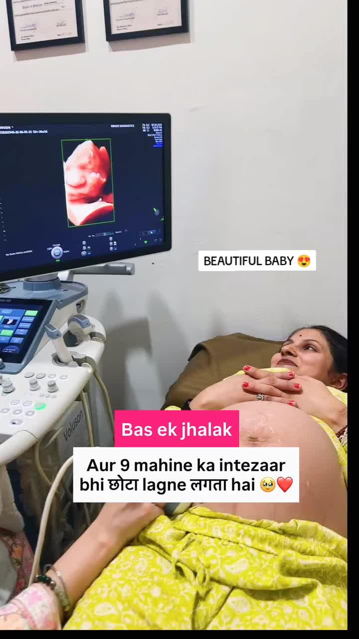 @Alina