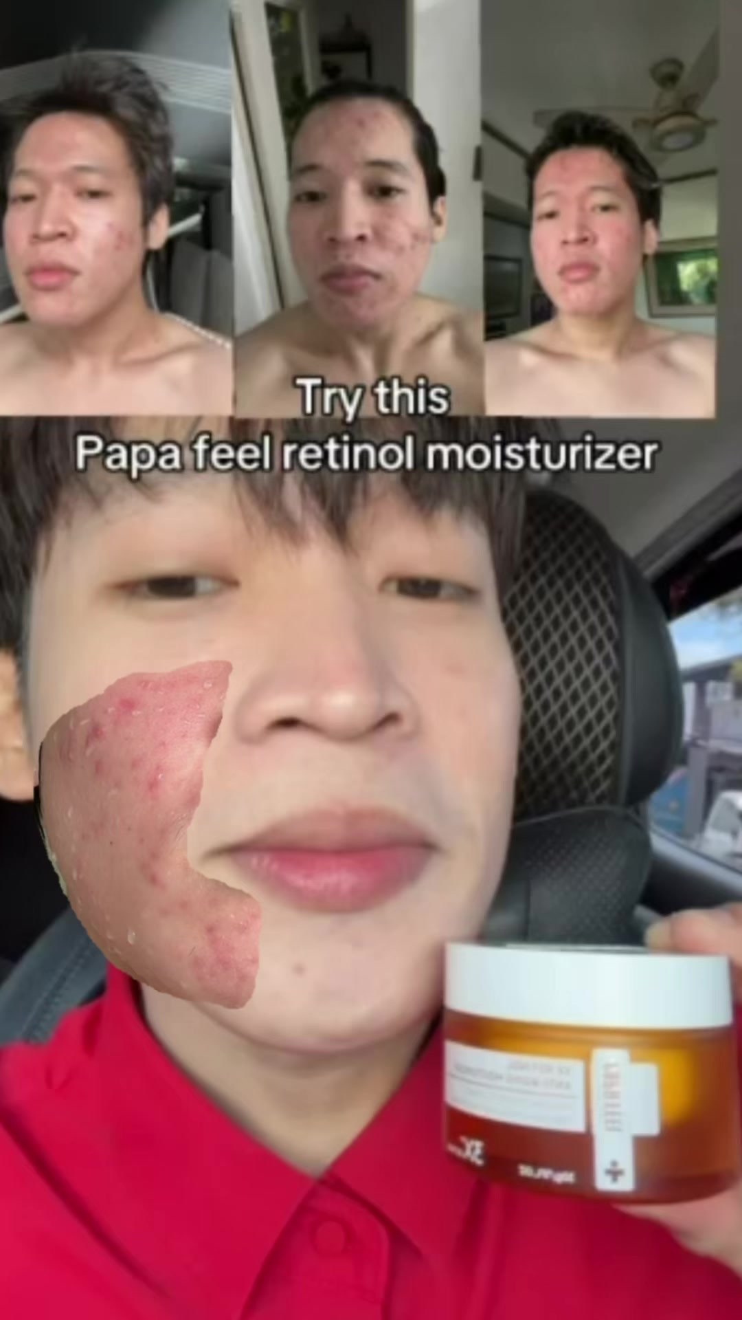 @marvin isanan