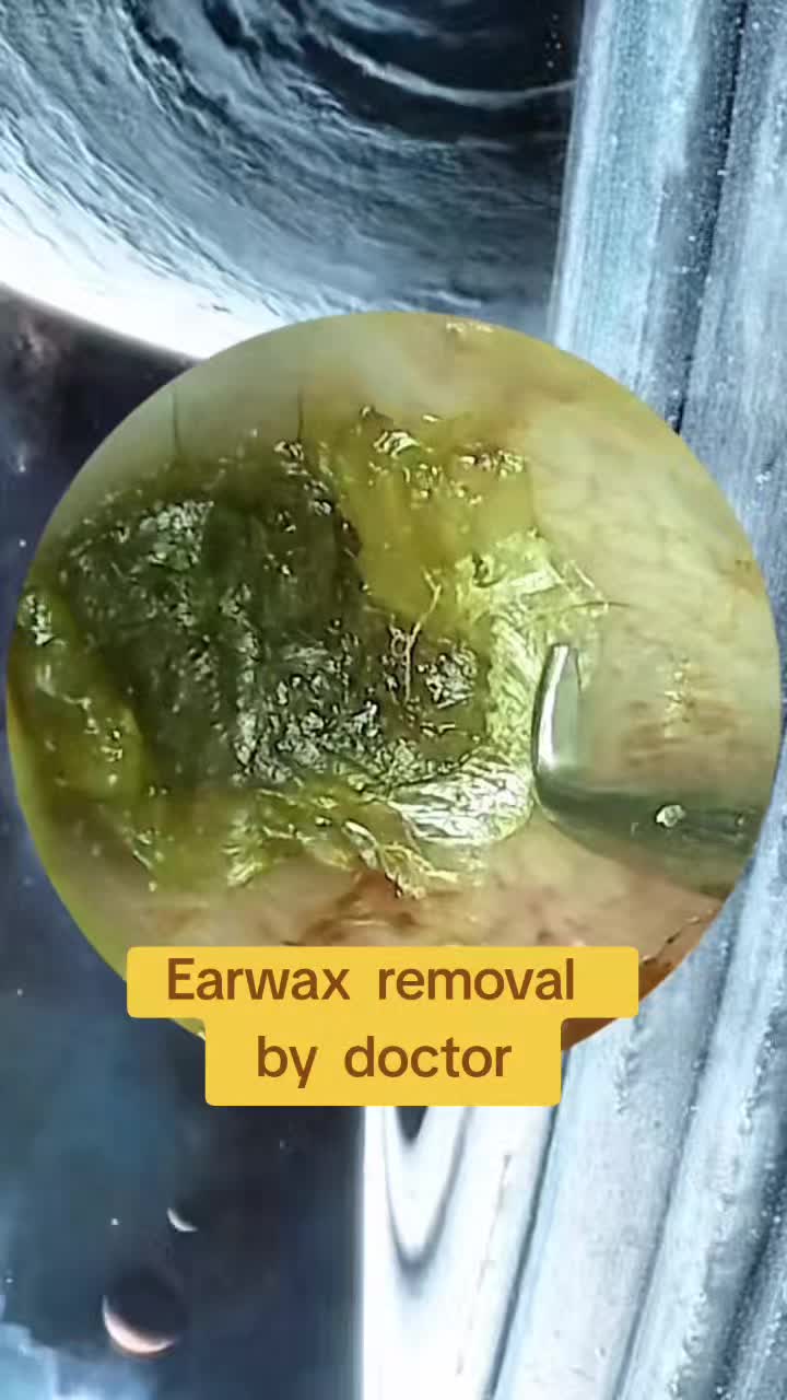@Earwax.pro