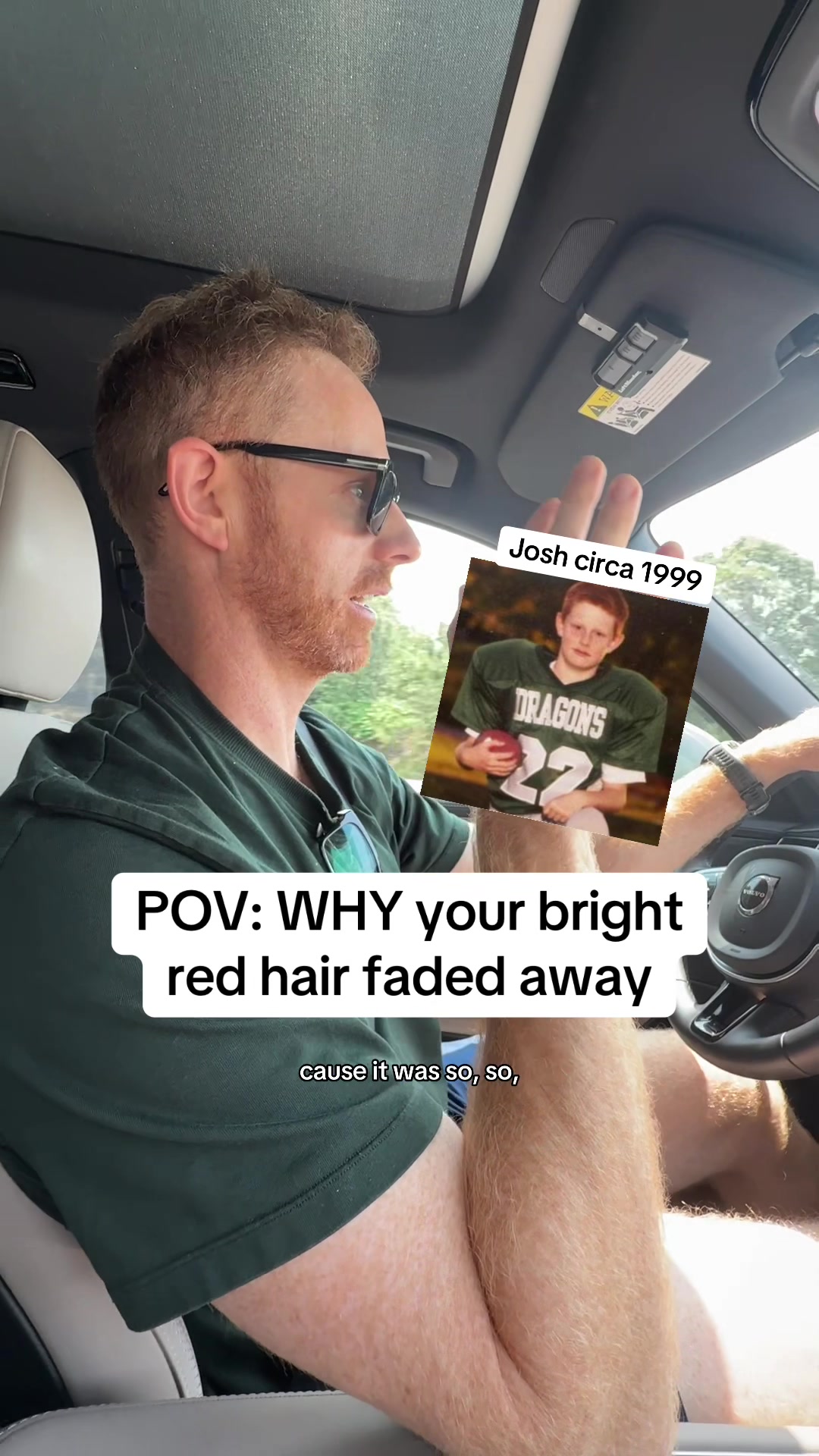 @How to be a Redhead
