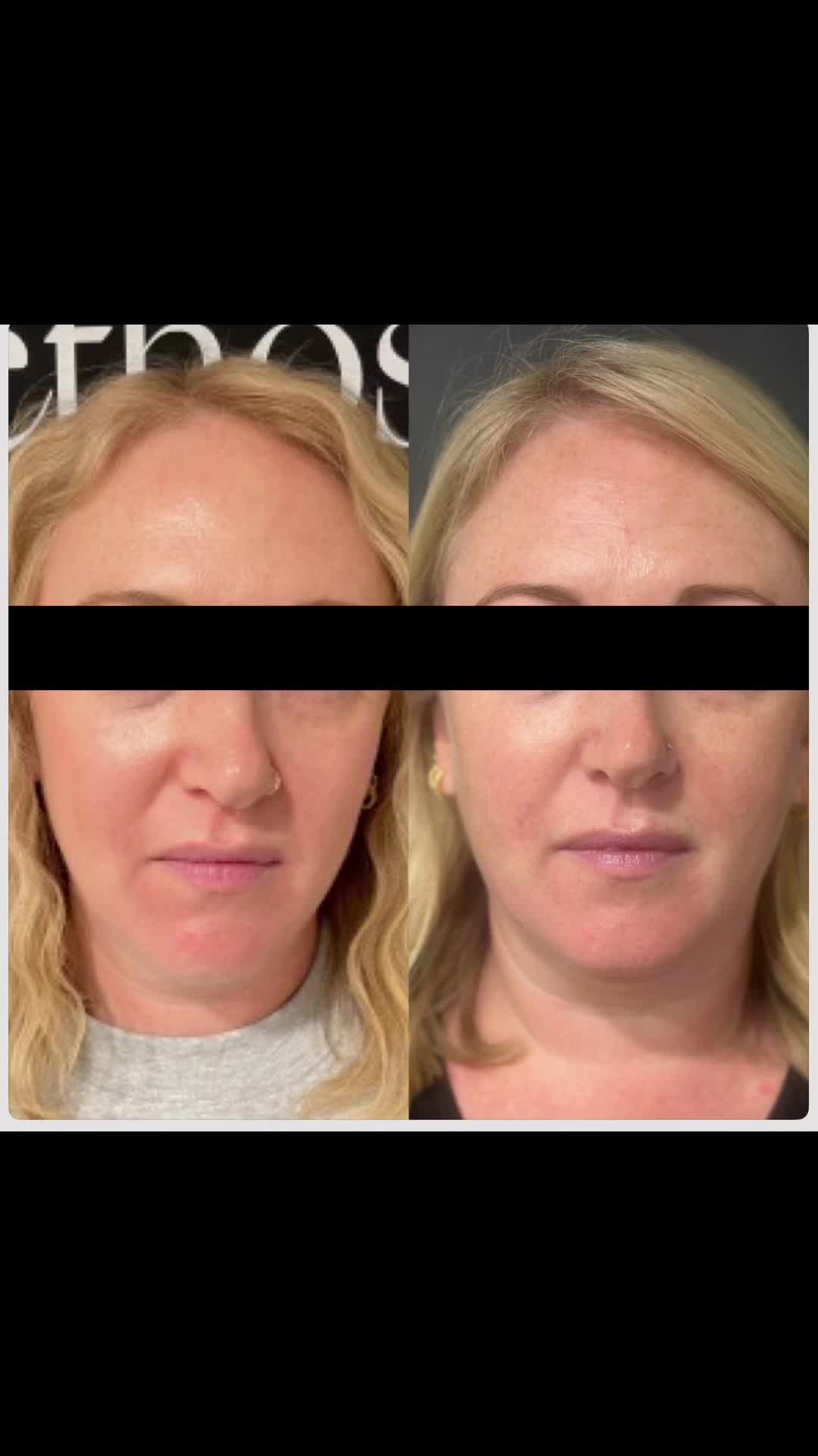 @injector.kate.ceccarelli