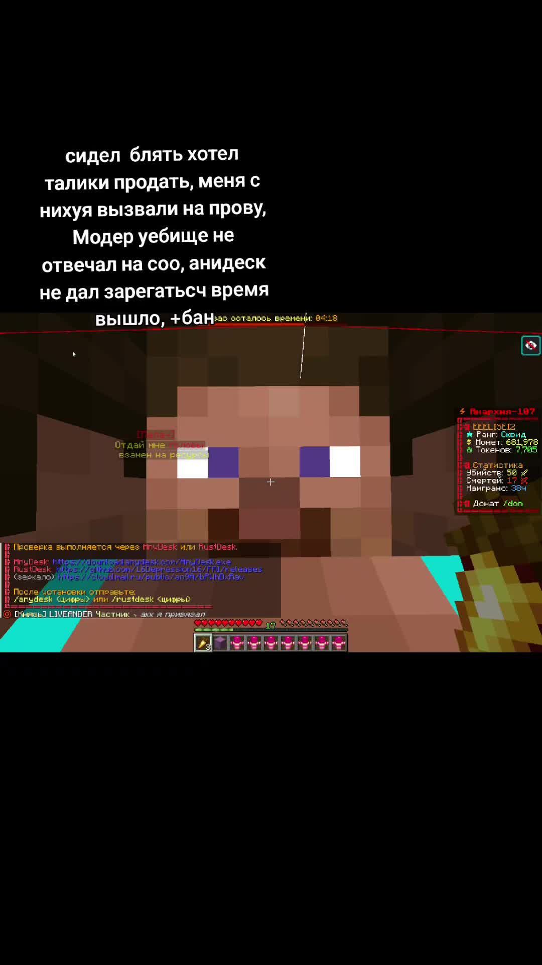 @Progasi_sm300pro
