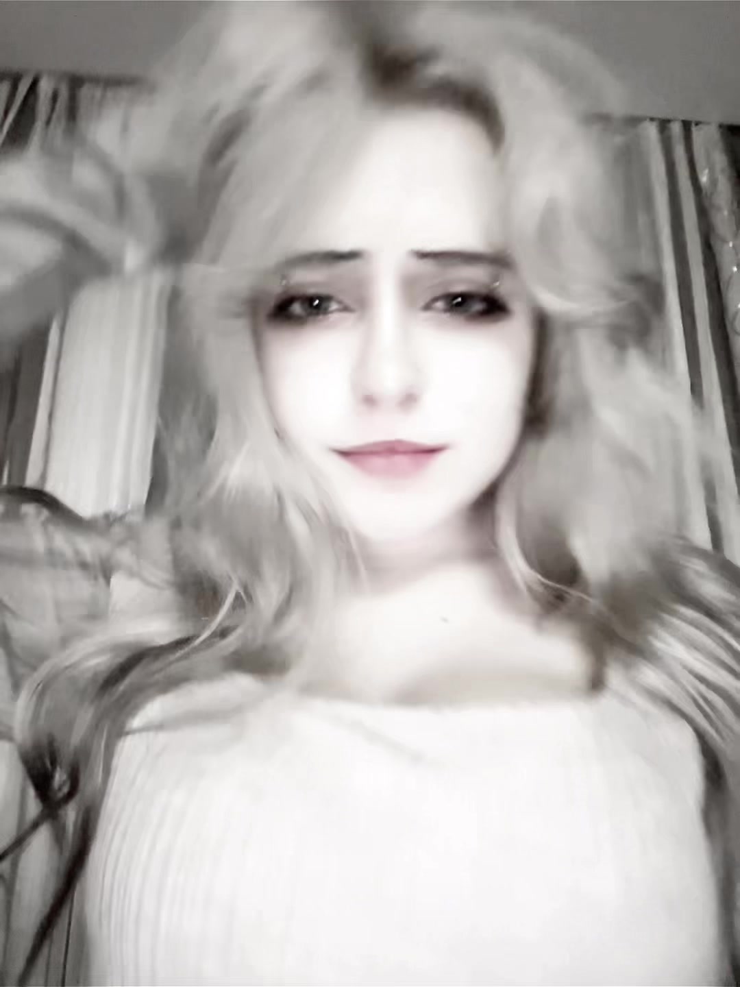 @uglyrosis