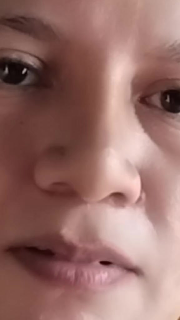 @live