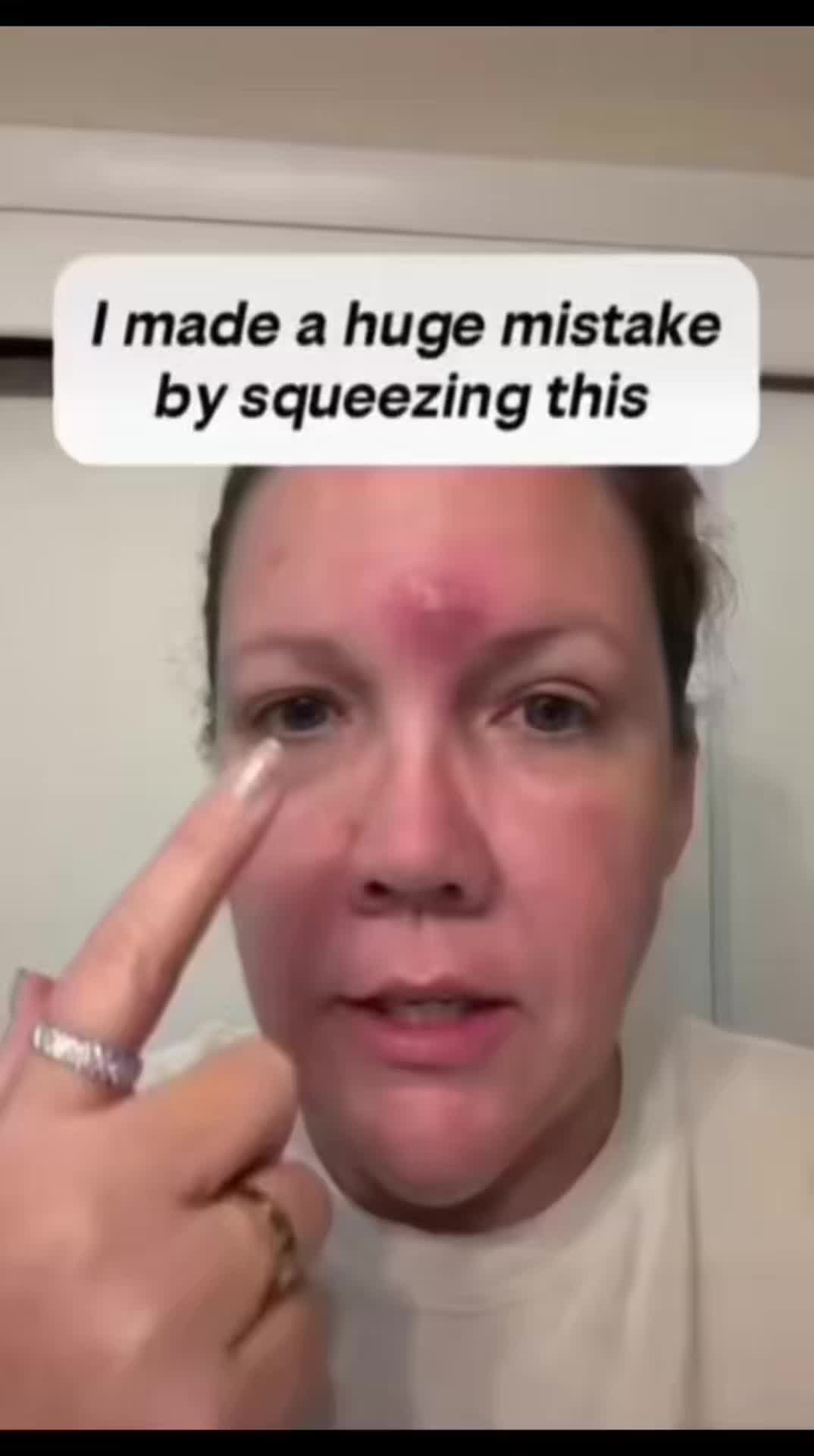 @Pure Skin OC