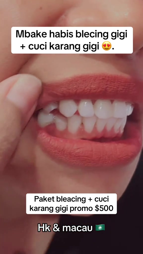 @mbak-Paijem