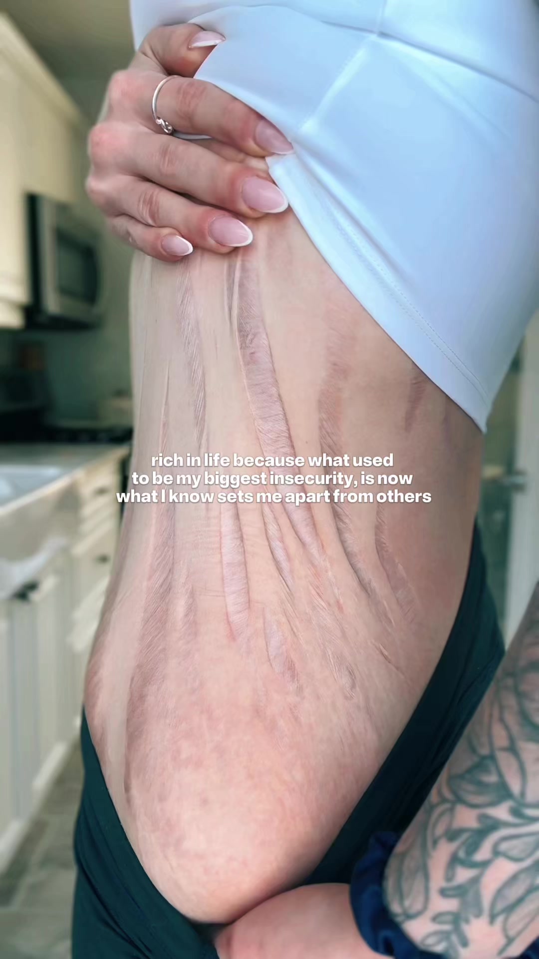 @Emma | weight loss & life