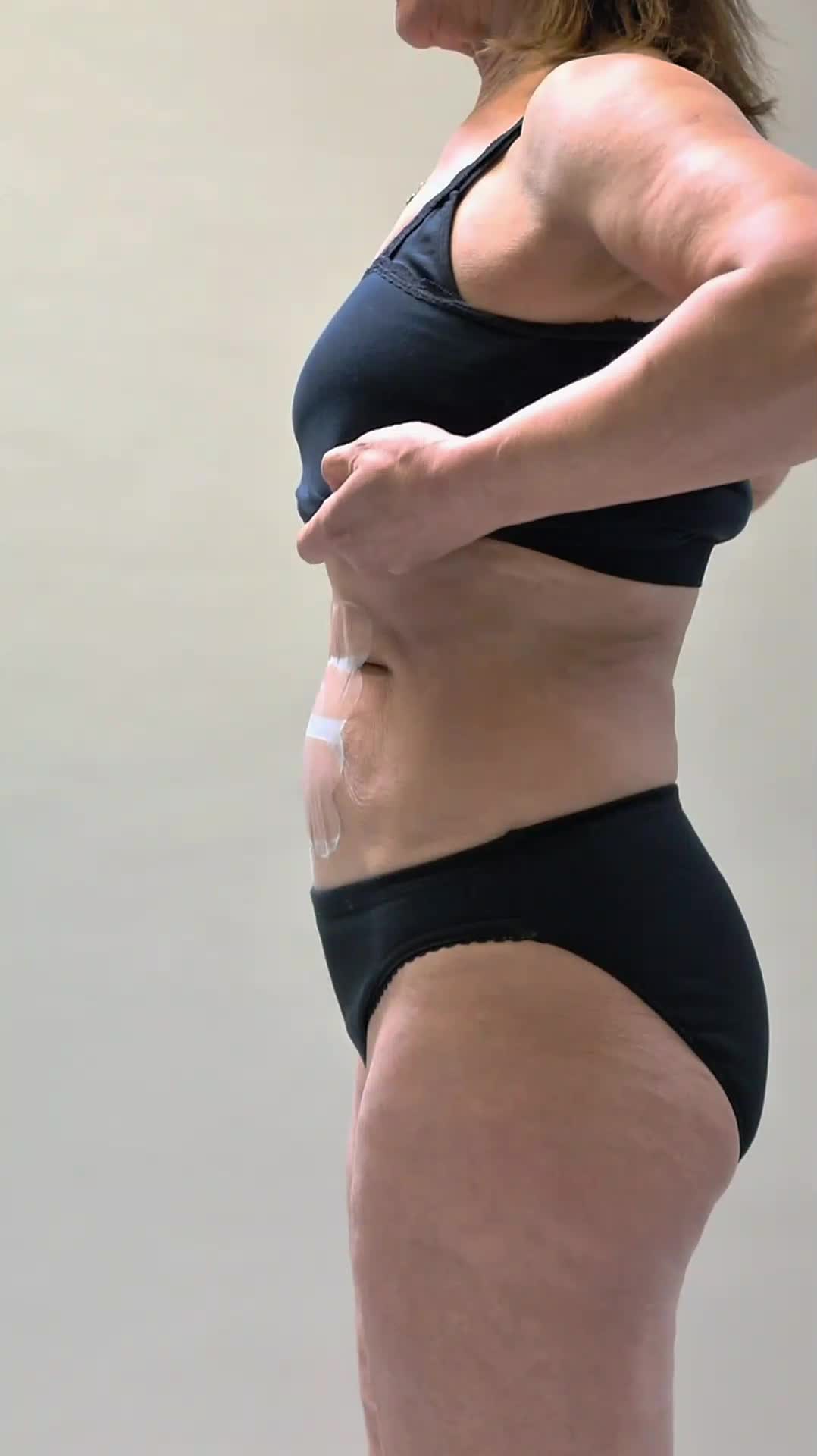 @Skinnies InstantLifts