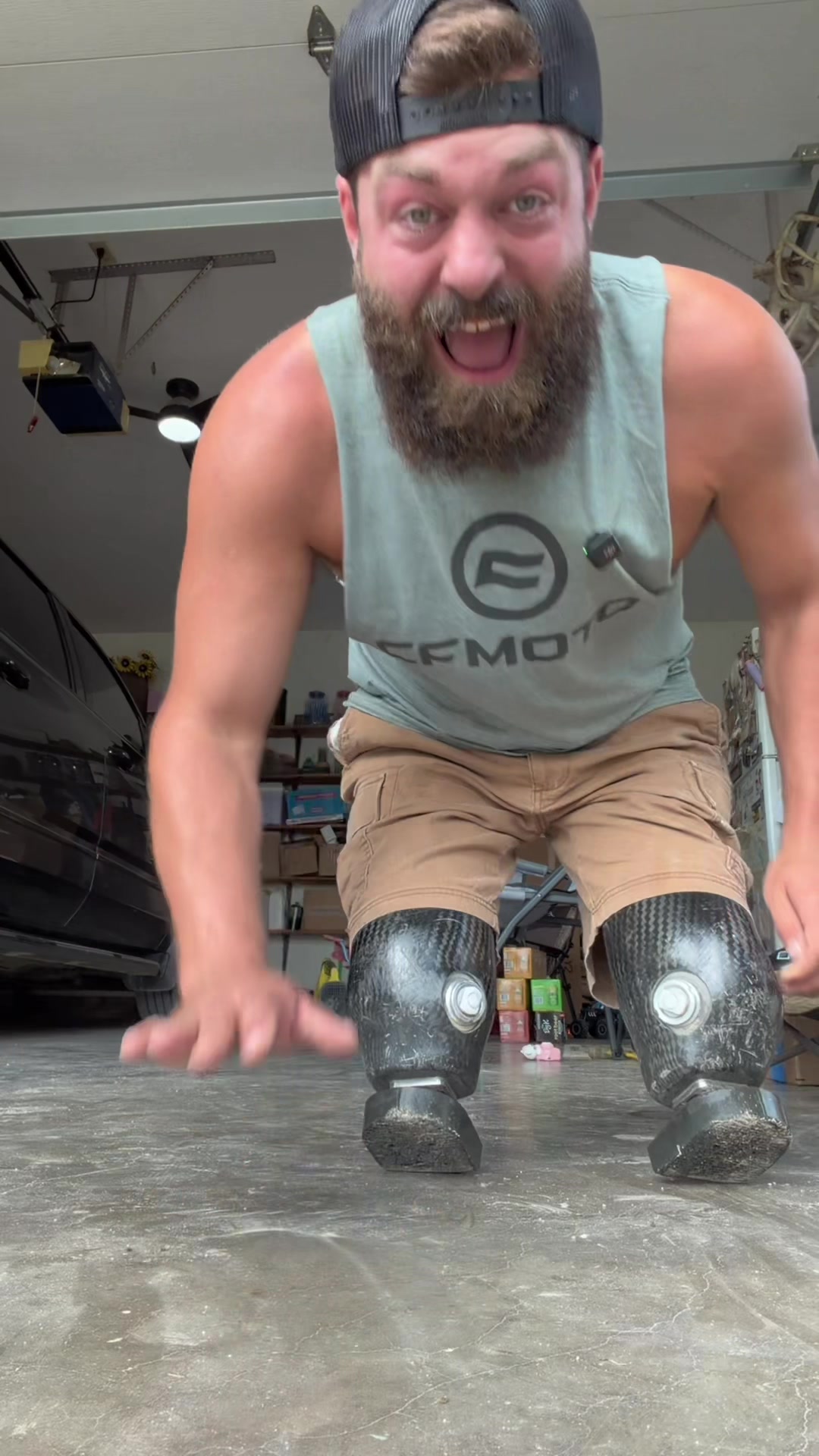 @Limb Loss Boss