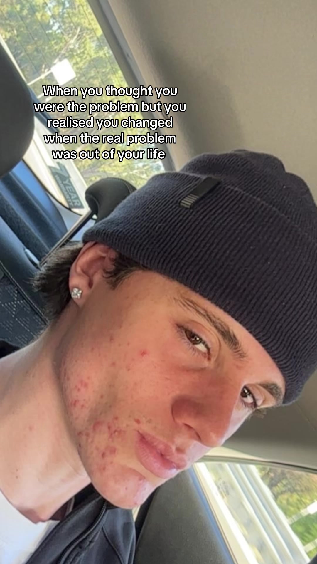 @KingMilan👅