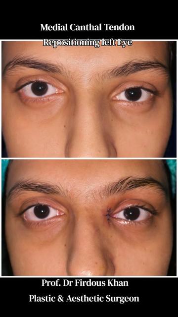 @Dr Firdous Khan PlasticSurgeon