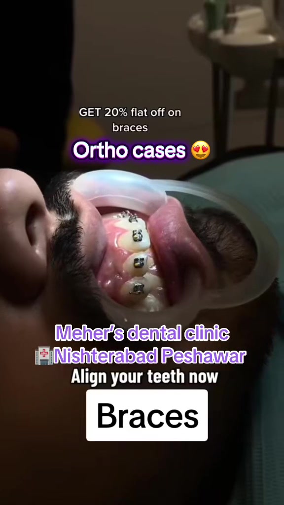 @dr_meher_official