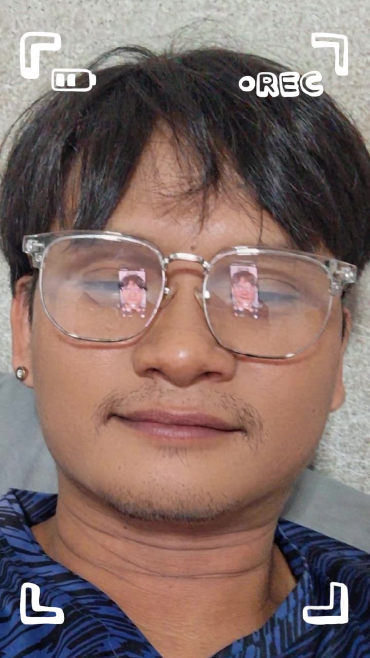 @win kyaw Aung๐๐๐๐๐