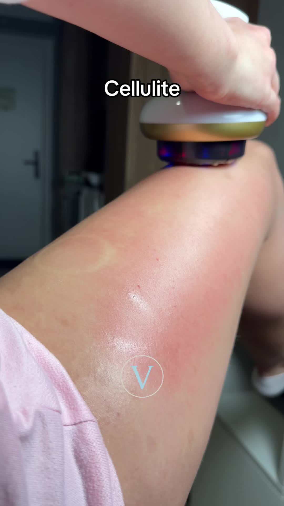 @vacuviaa
