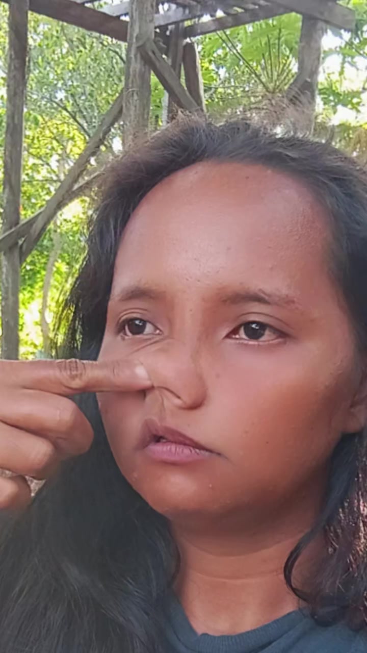 @bungal🤪✅