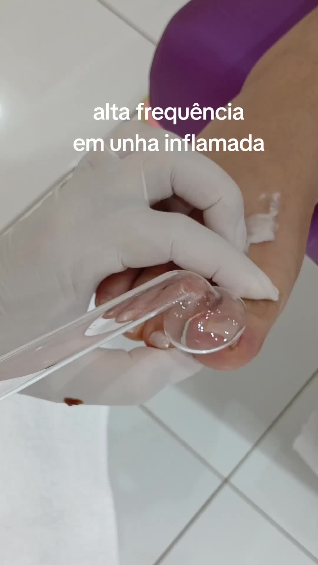 @Cl&iacute;nica dos p&eacute;s 👣
