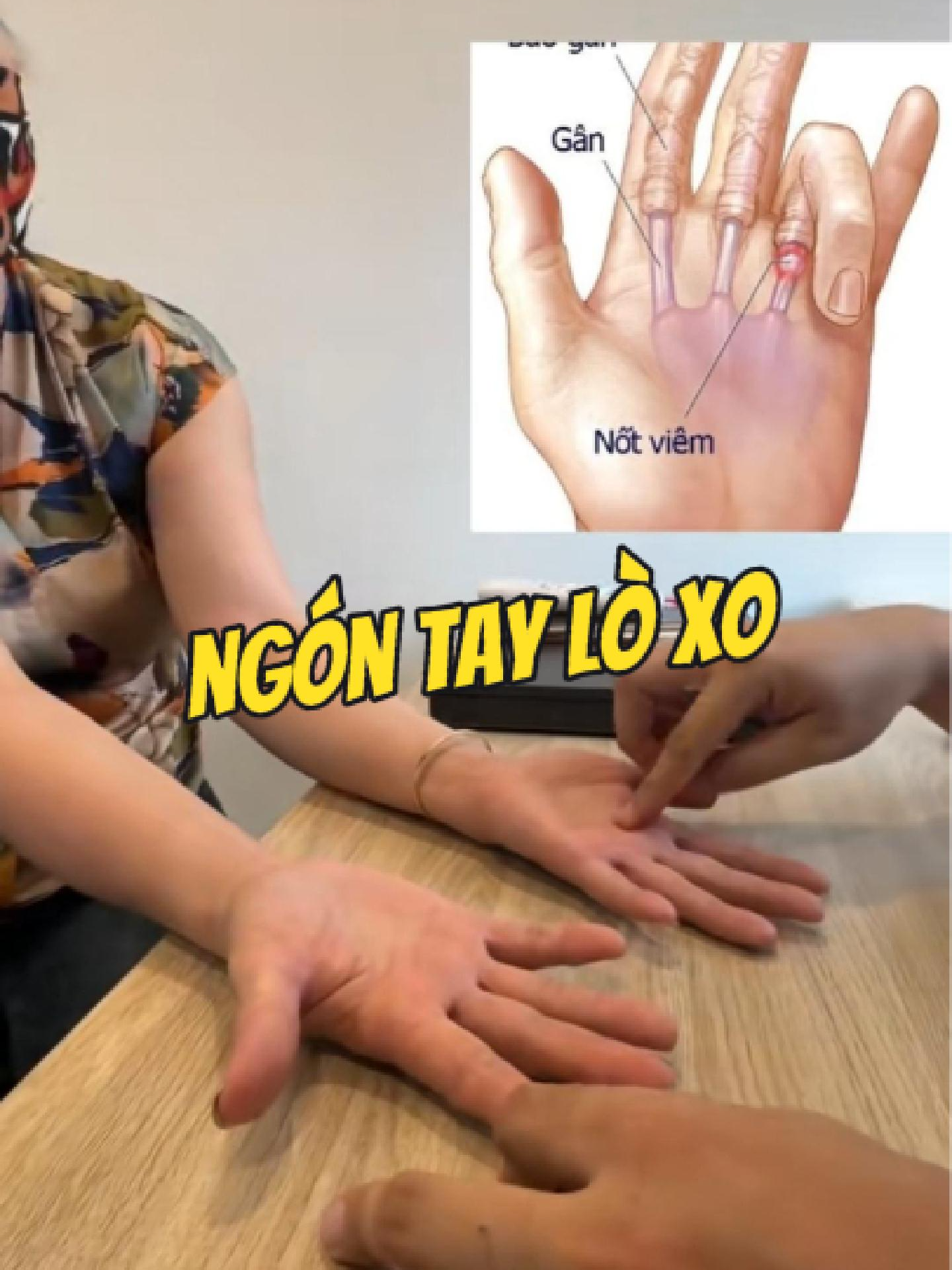@Chuy&ecirc;n gia xương khớp