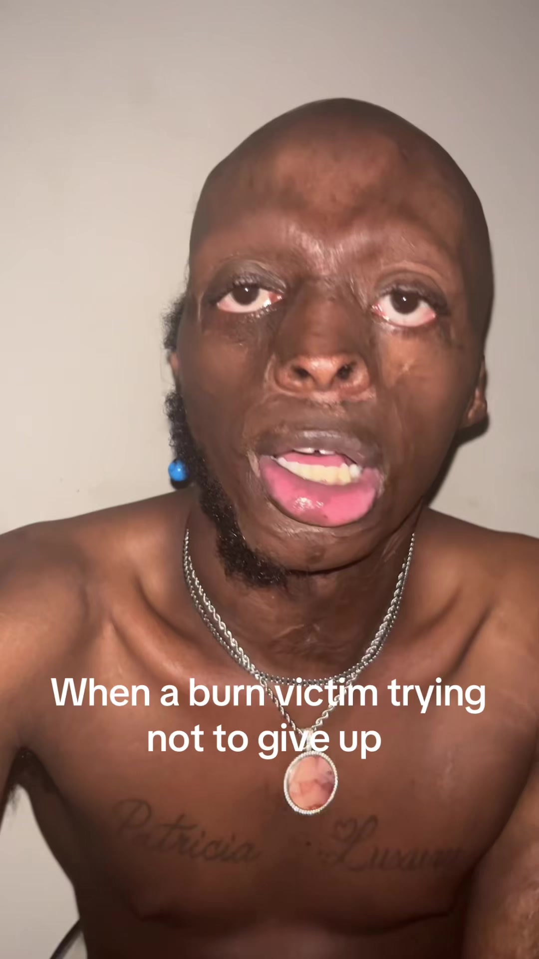 @burntfolks00