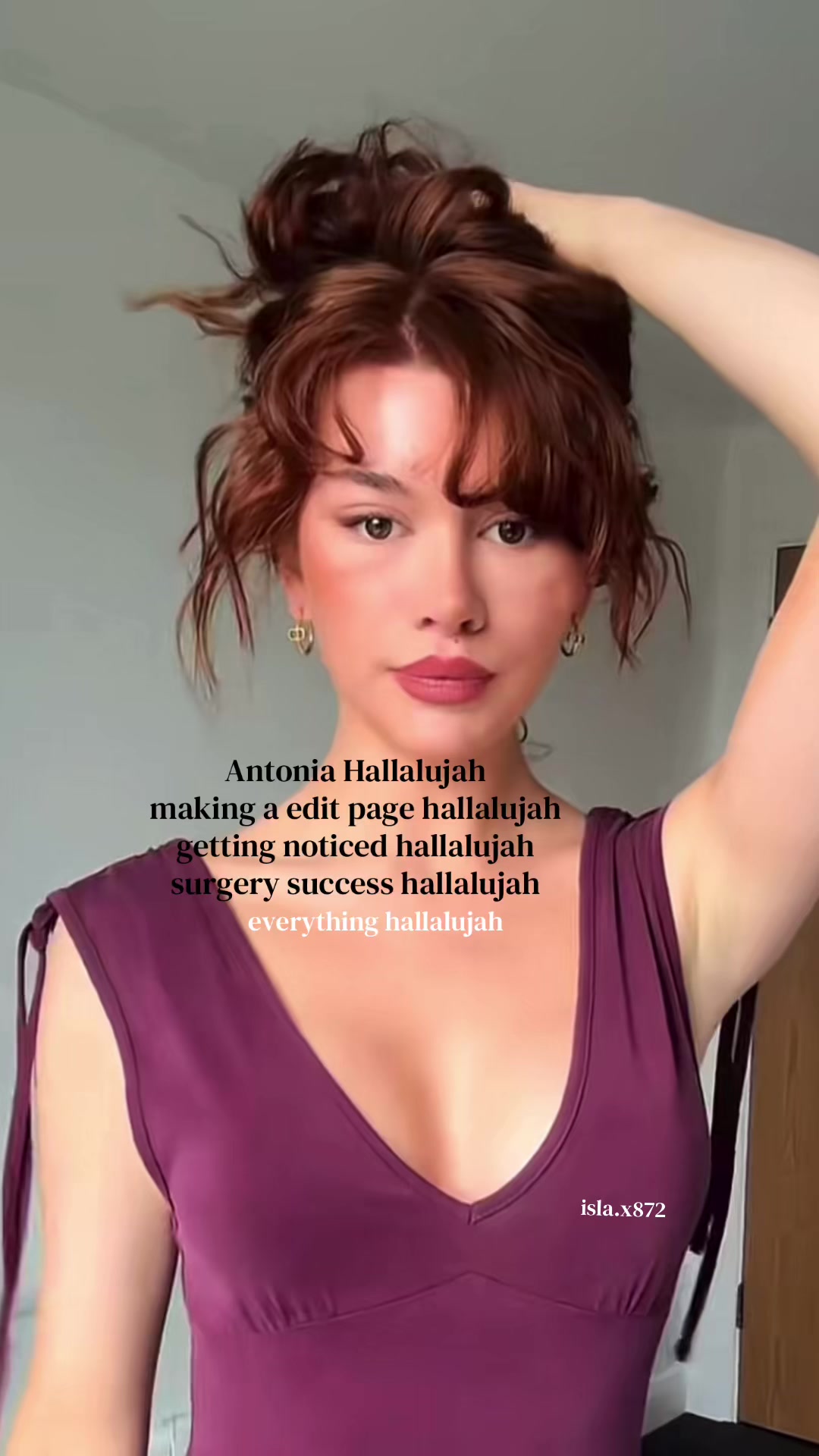 @Fanpage 🫶🏼