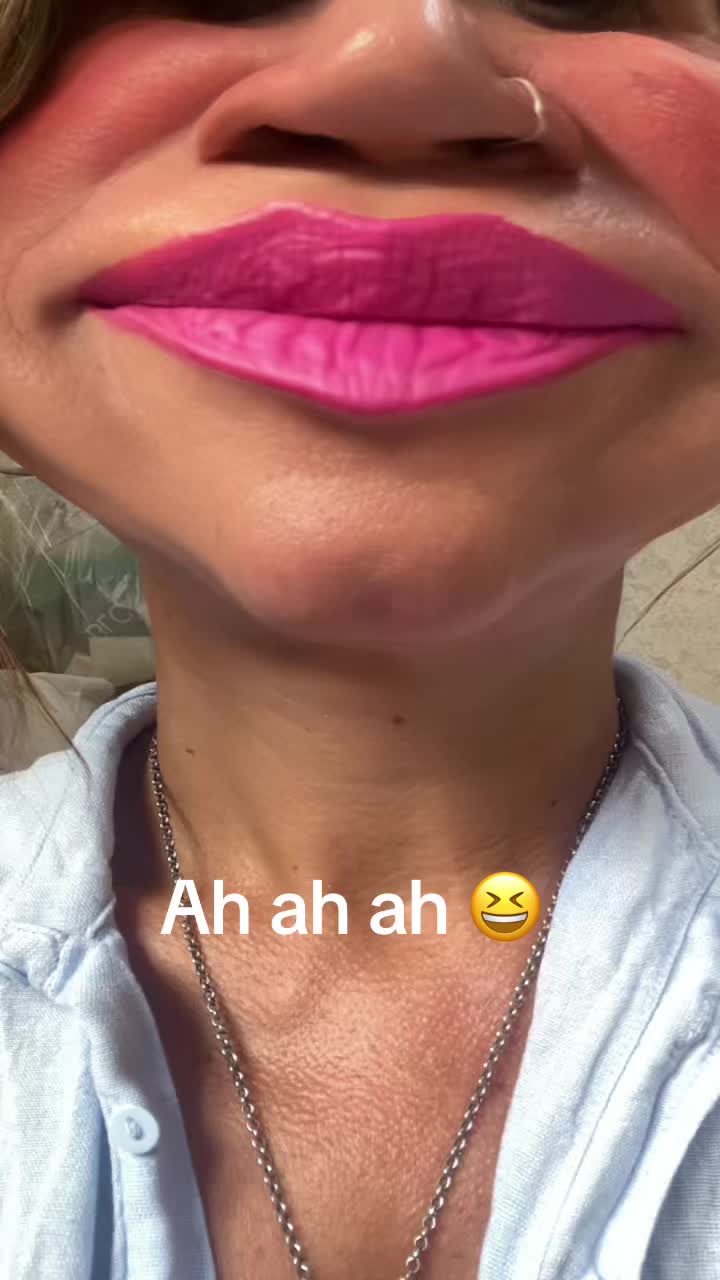 @MIRELLA-ZOE