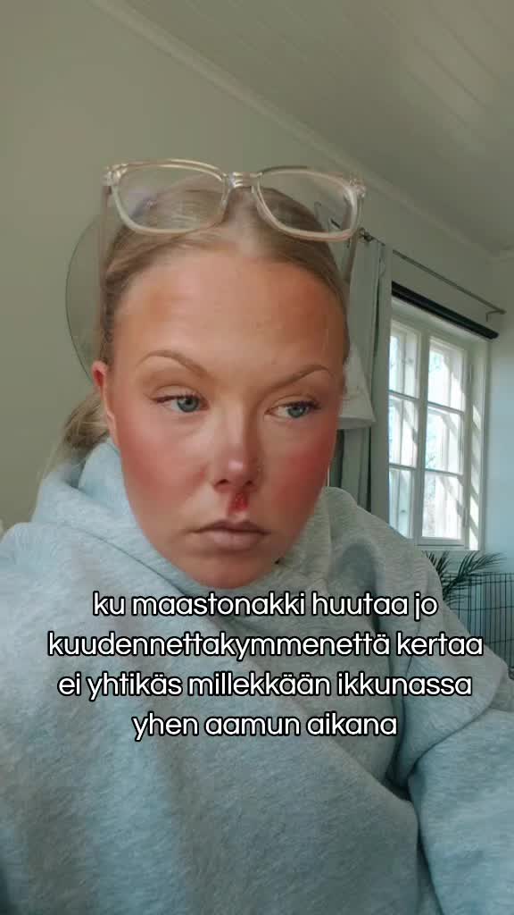 @Anna
