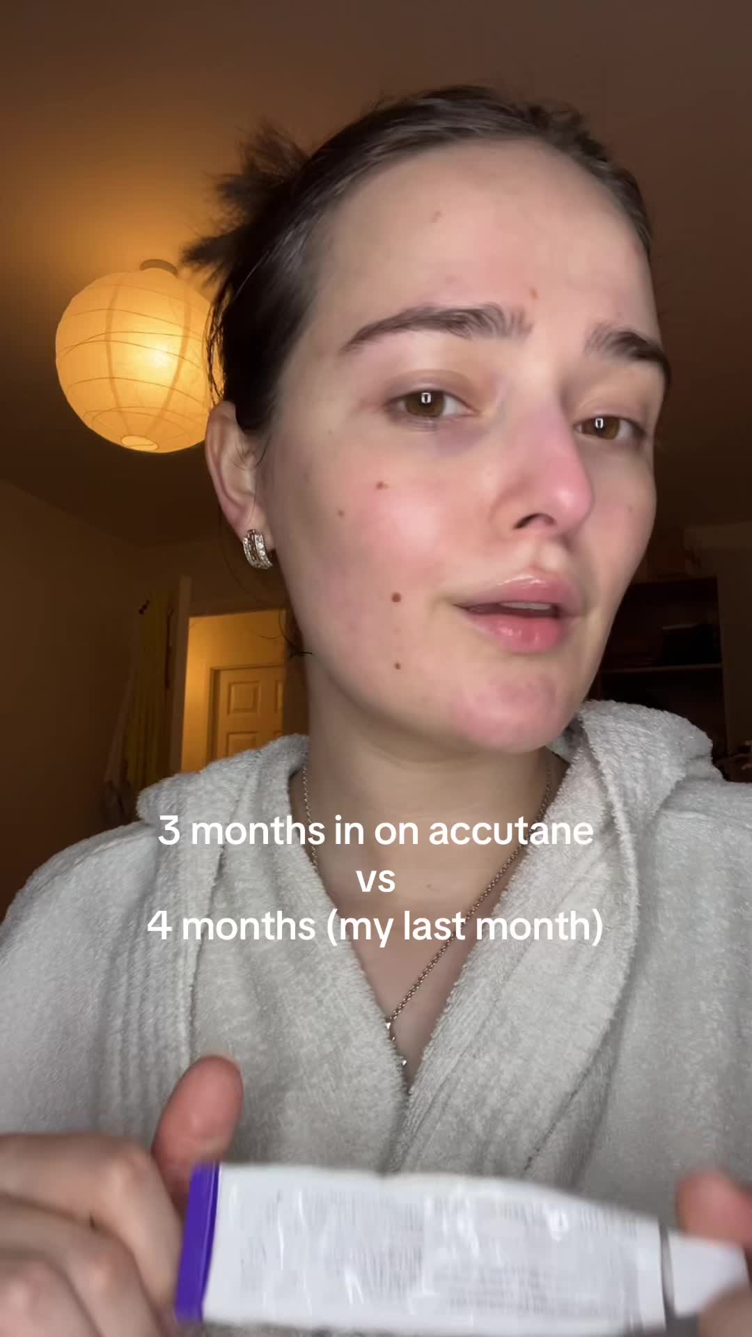 @andreea_skintok