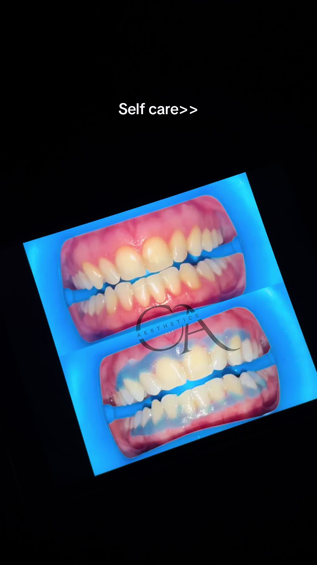@Halal Teeth Whitening London